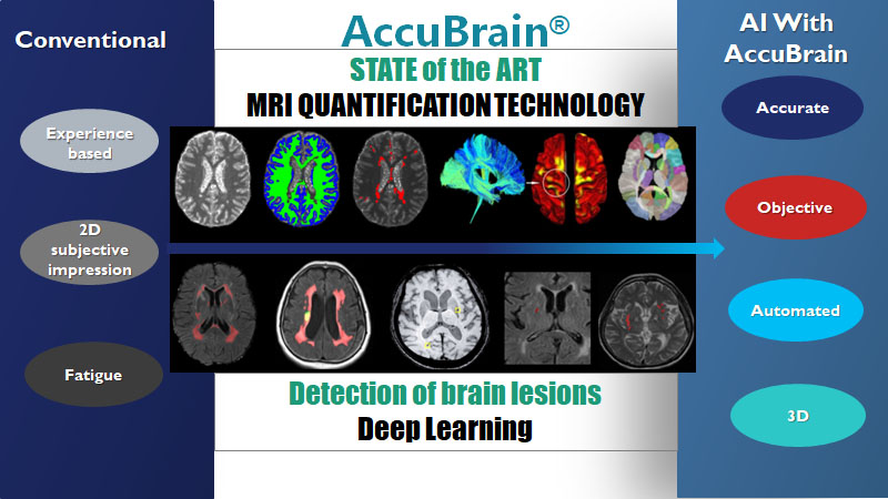 AccuBrain STATE of the ART